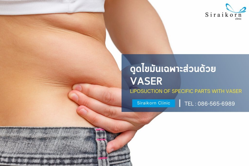 รู้จักเครื่อง Vaser ดูดไขมัน