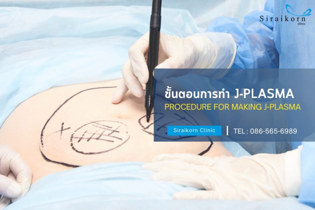 ขั้นตอนการทำJplasma