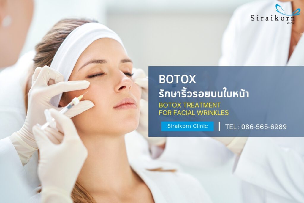 รักษาริ้วรอย botox โบท็อกซ์