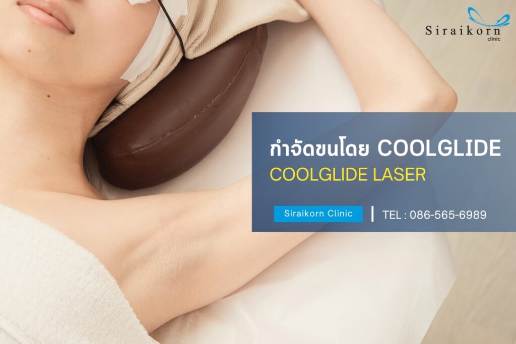 กำขัดขนด้วย coolglide